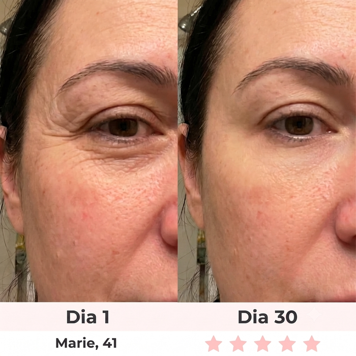 Antes y después — Rosa, 44