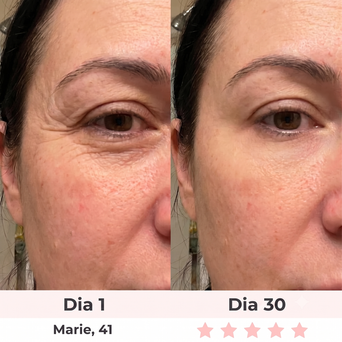 Antes y después — Rosa, 44