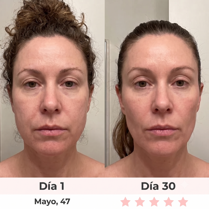 Antes y después — Patricia, 53