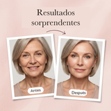 bf-es-antes-despues