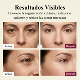 bf-es-resultados