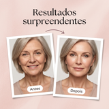 Antes e depois: pele mais firme e definida