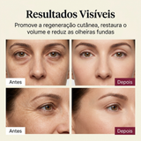 Resultados visiveis nas olheiras e rugas