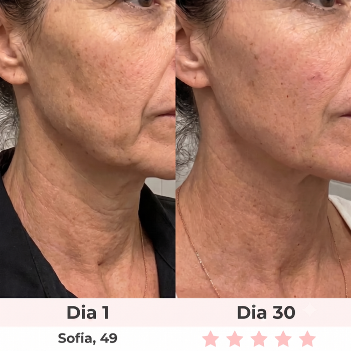 Antes y después — Maria, 47