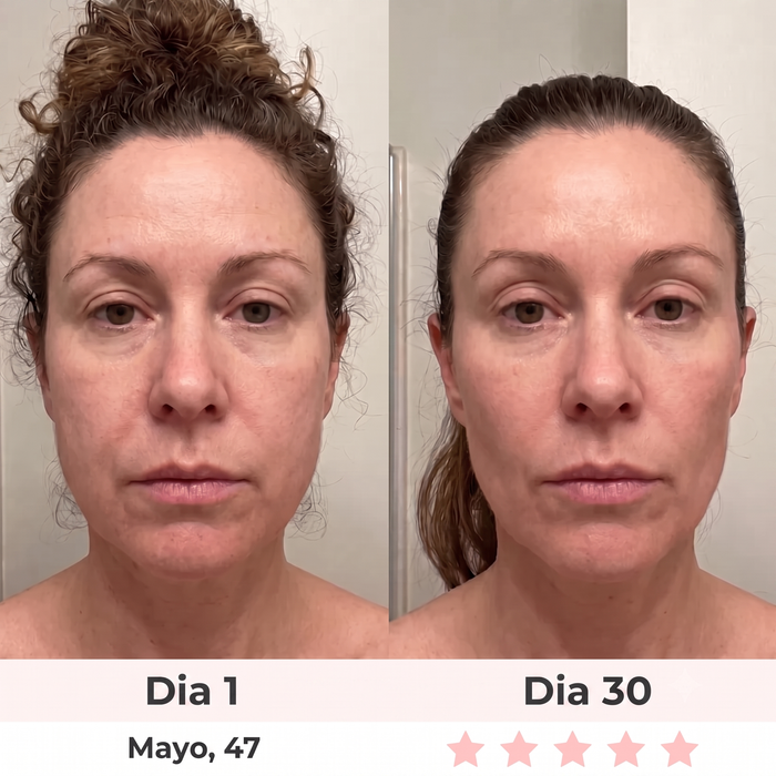 Antes y después — Patrícia, 53